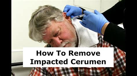 cerumen impaction tests|treatment for cerumen impaction.